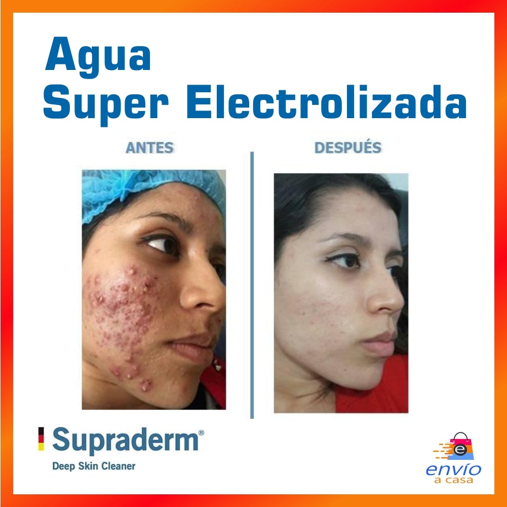 Agua Super Electrolizada - NANO Piel